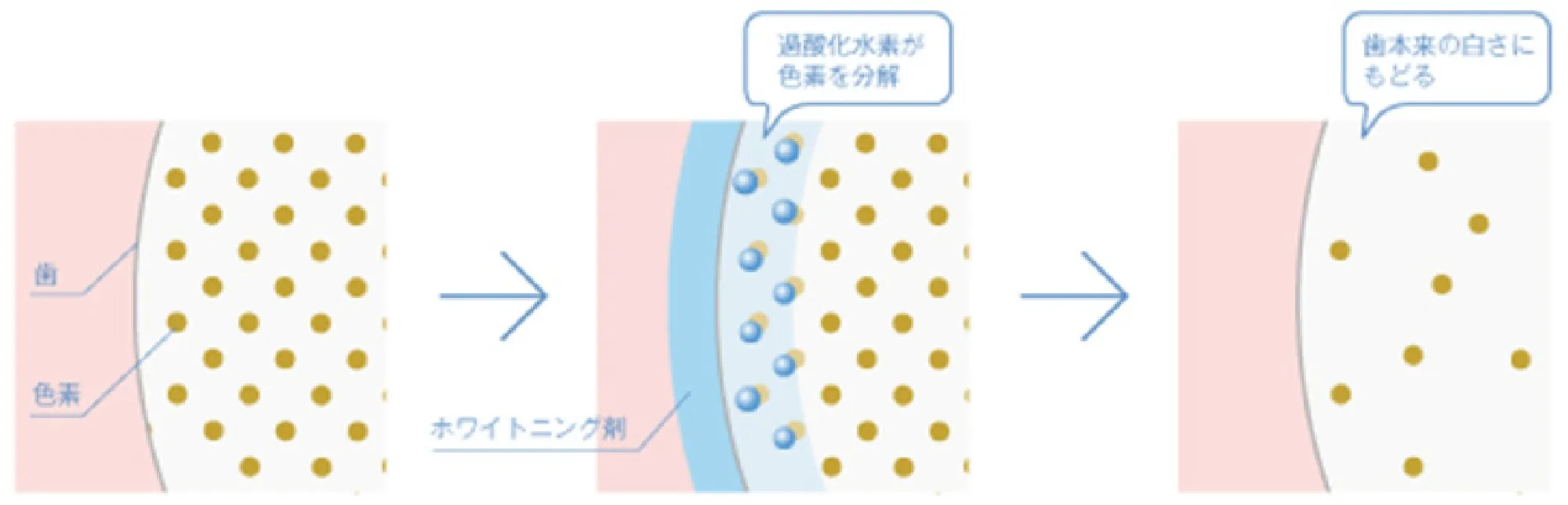 ホワイトニング薬剤の仕組み