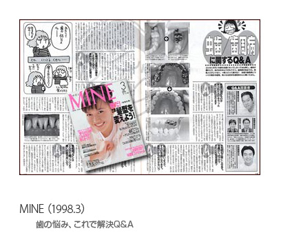 MINE（1998.3）