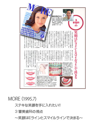 MORE（1995.7）