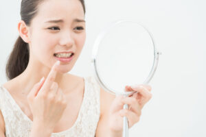 歯が汚くて恥ずかしい。綺麗にする方法はある?汚れに合わせた治療を紹介!