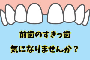 前歯のすきっ歯が気になる！すきっ歯の原因と治療法を解説！