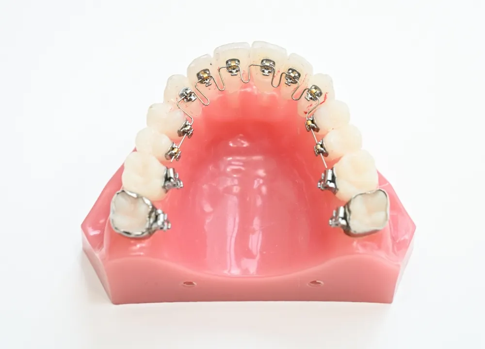 矯正歯科 | 中目黒の歯医者 アトラスタワーデンタルクリニック